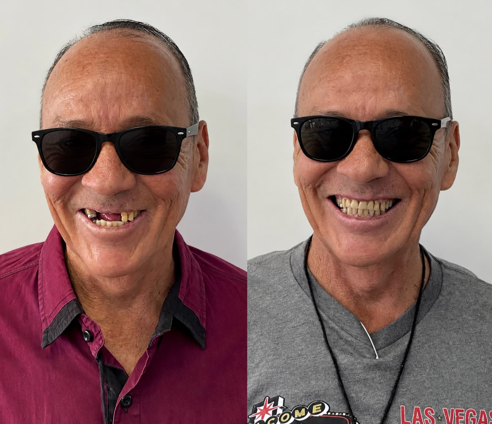 Evolución de sonrisa con tratamiento dental personalizado en Dental Wox, Guadalajara