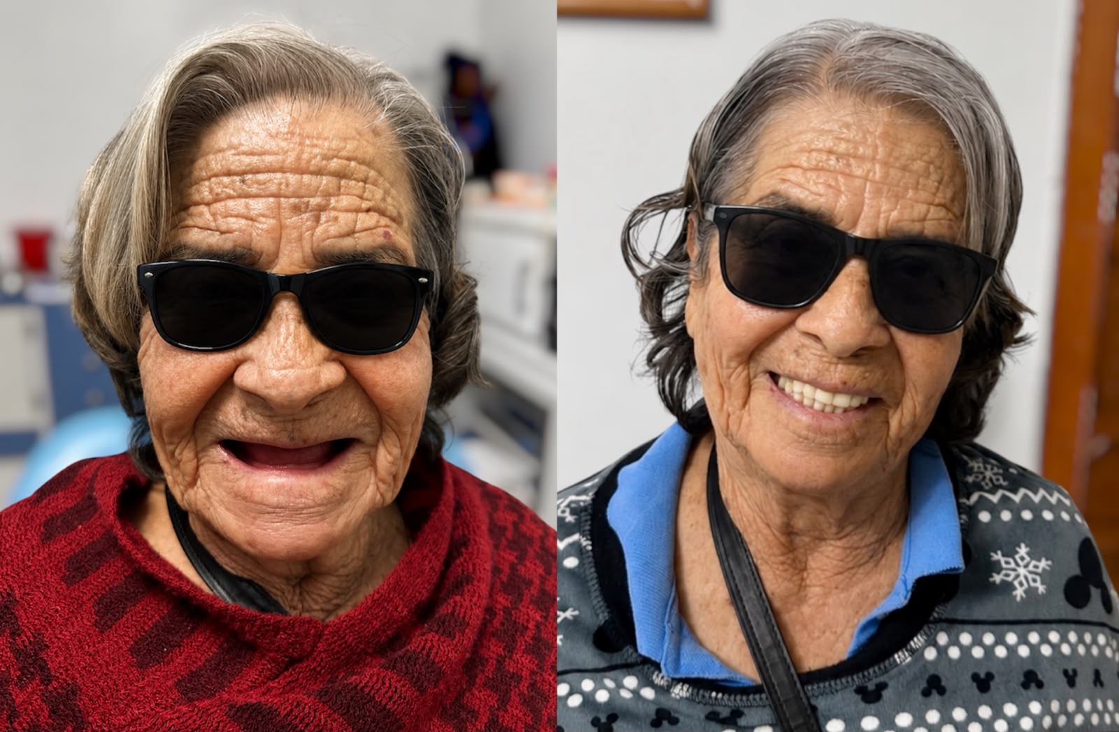 Resultado de tratamiento personalizado en clínica dental Guadalajara — Dental Wox