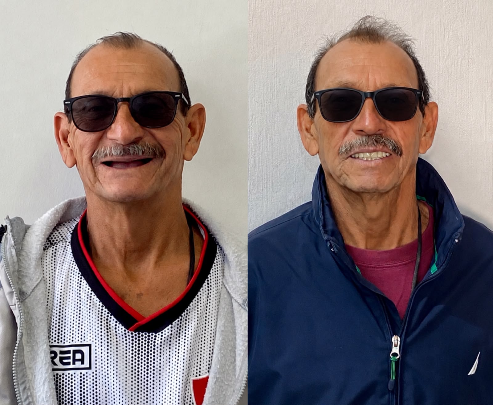 Transformación de sonrisa antes y después en Dental Wox, Guadalajara